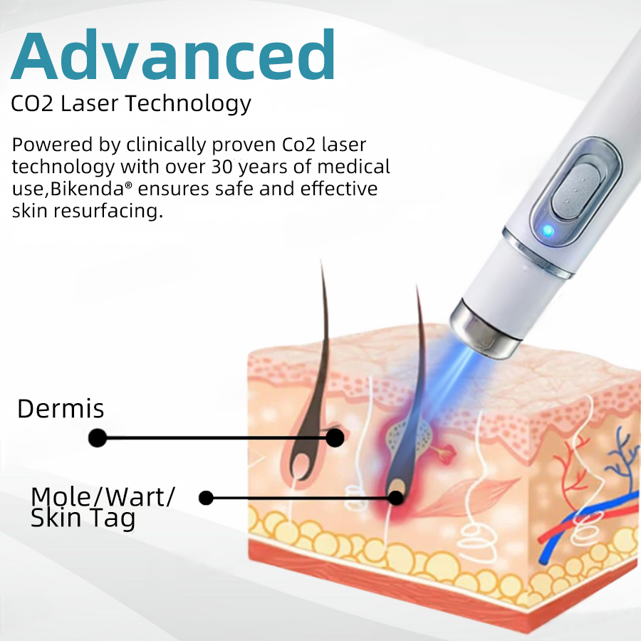 🔥This Week's Hot Deal🔥 Mole and Wart Removal Pen