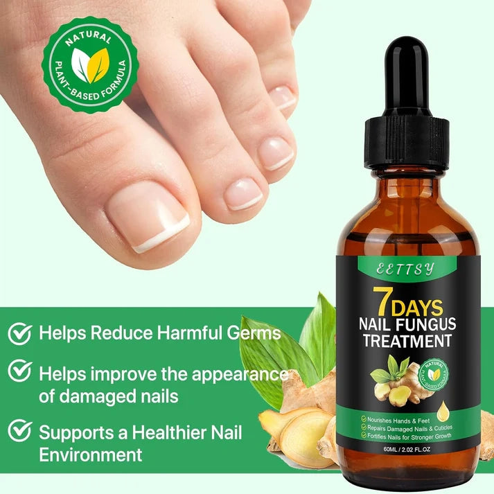 🔥This week's hot sale🔥Ginger Nail Care Solution