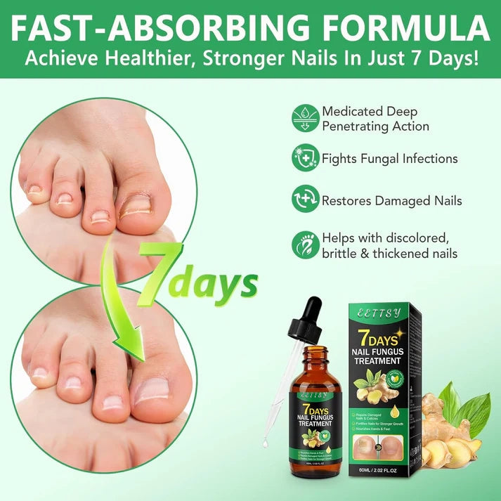 🔥This week's hot sale🔥Ginger Nail Care Solution