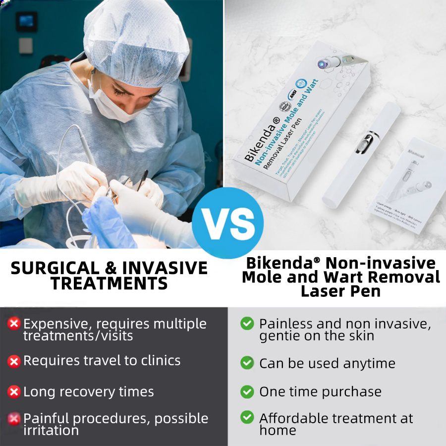🔥This Week's Hot Deal🔥 Mole and Wart Removal Pen