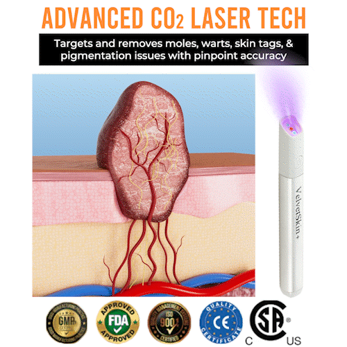 🔥This week's hot sale🔥All in One Laser Eraser Pen