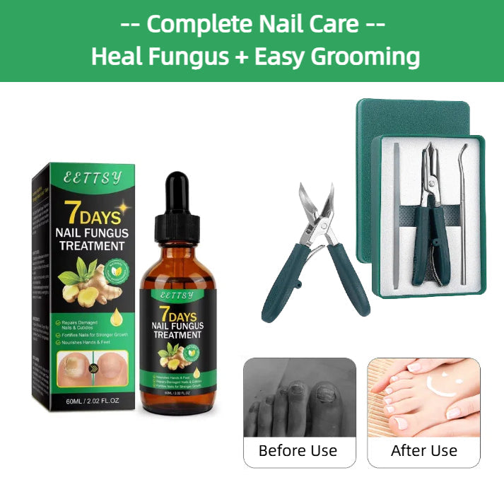 🔥This week's hot sale🔥Ginger Nail Care Solution