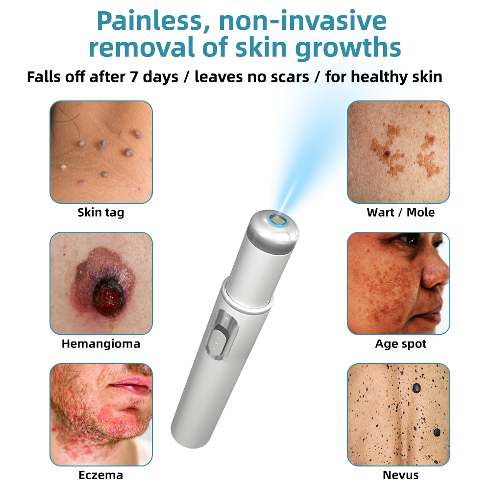 🔥This Week's Hot Deal🔥 Mole and Wart Removal Pen