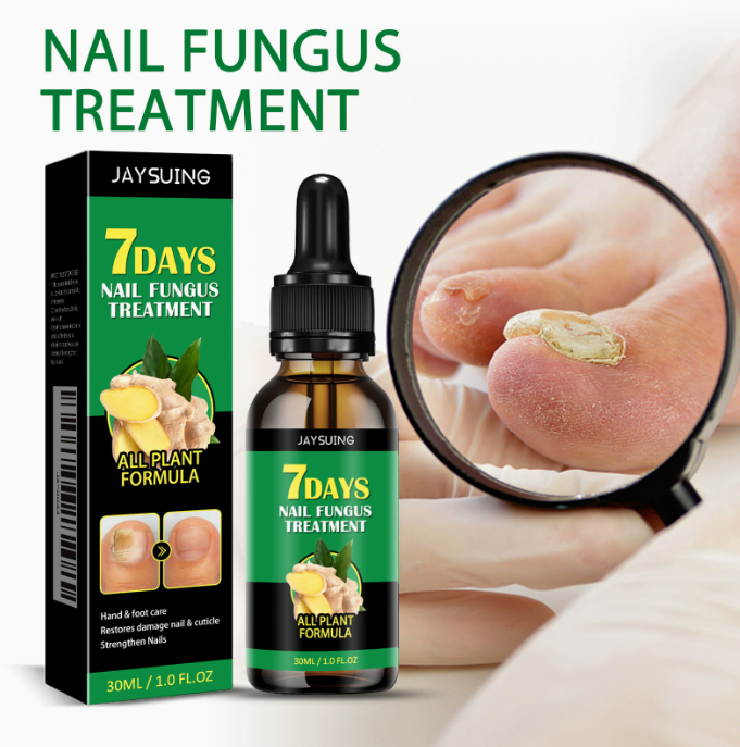 🔥This week's hot sale🔥Ginger Nail Care Solution