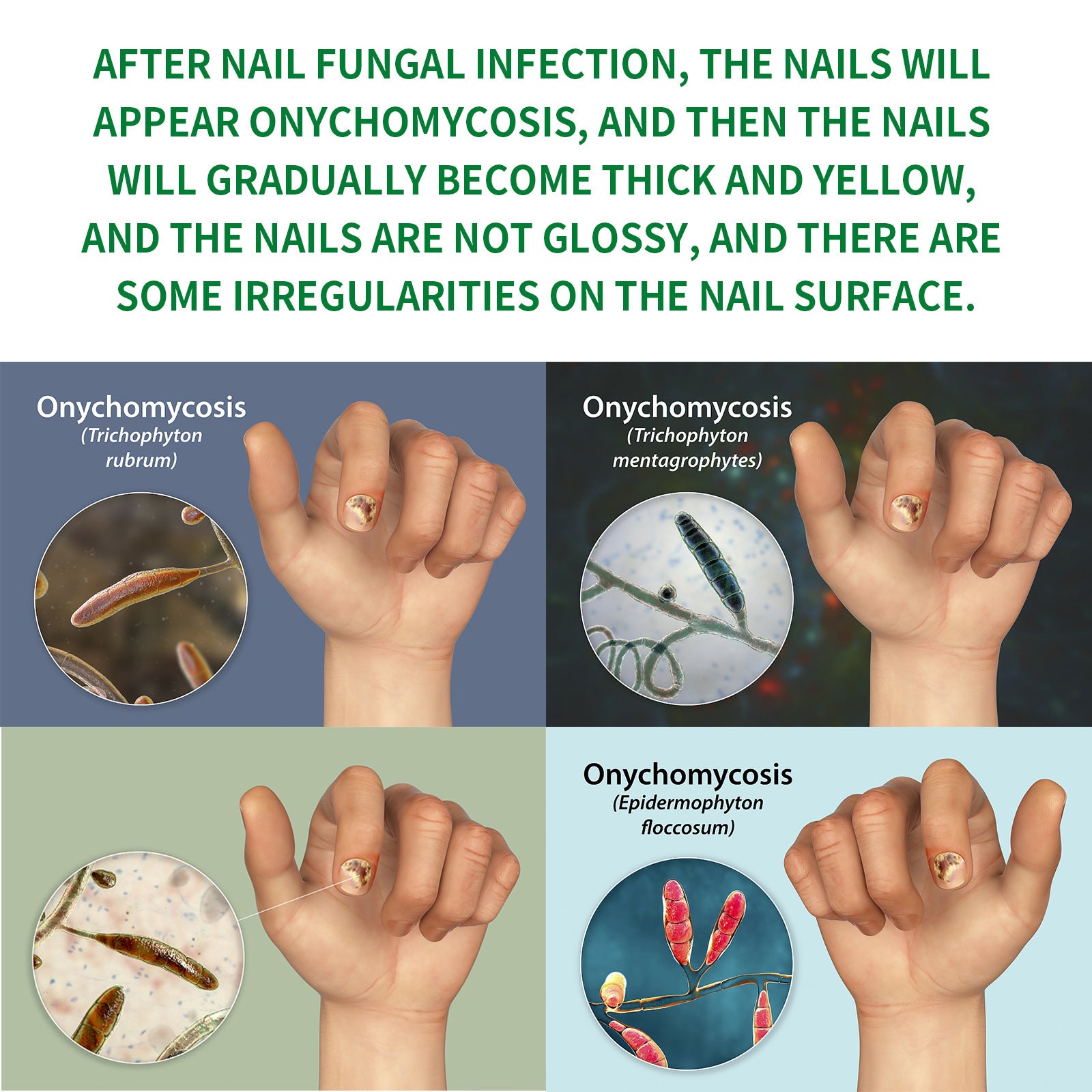🔥This week's hot sale🔥Ginger Nail Care Solution