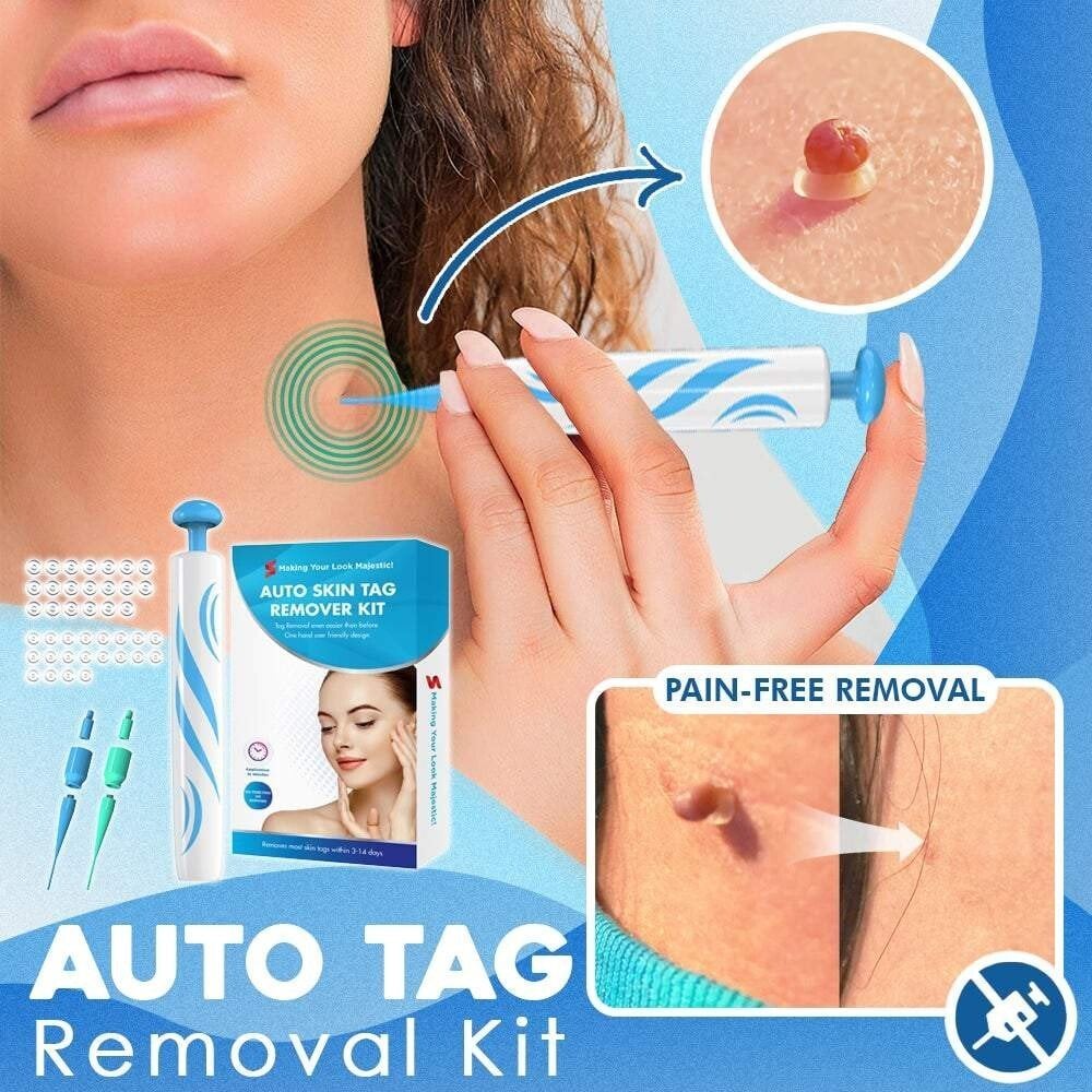 🔥This week's hot sale🔥 fast auto tag removal kit