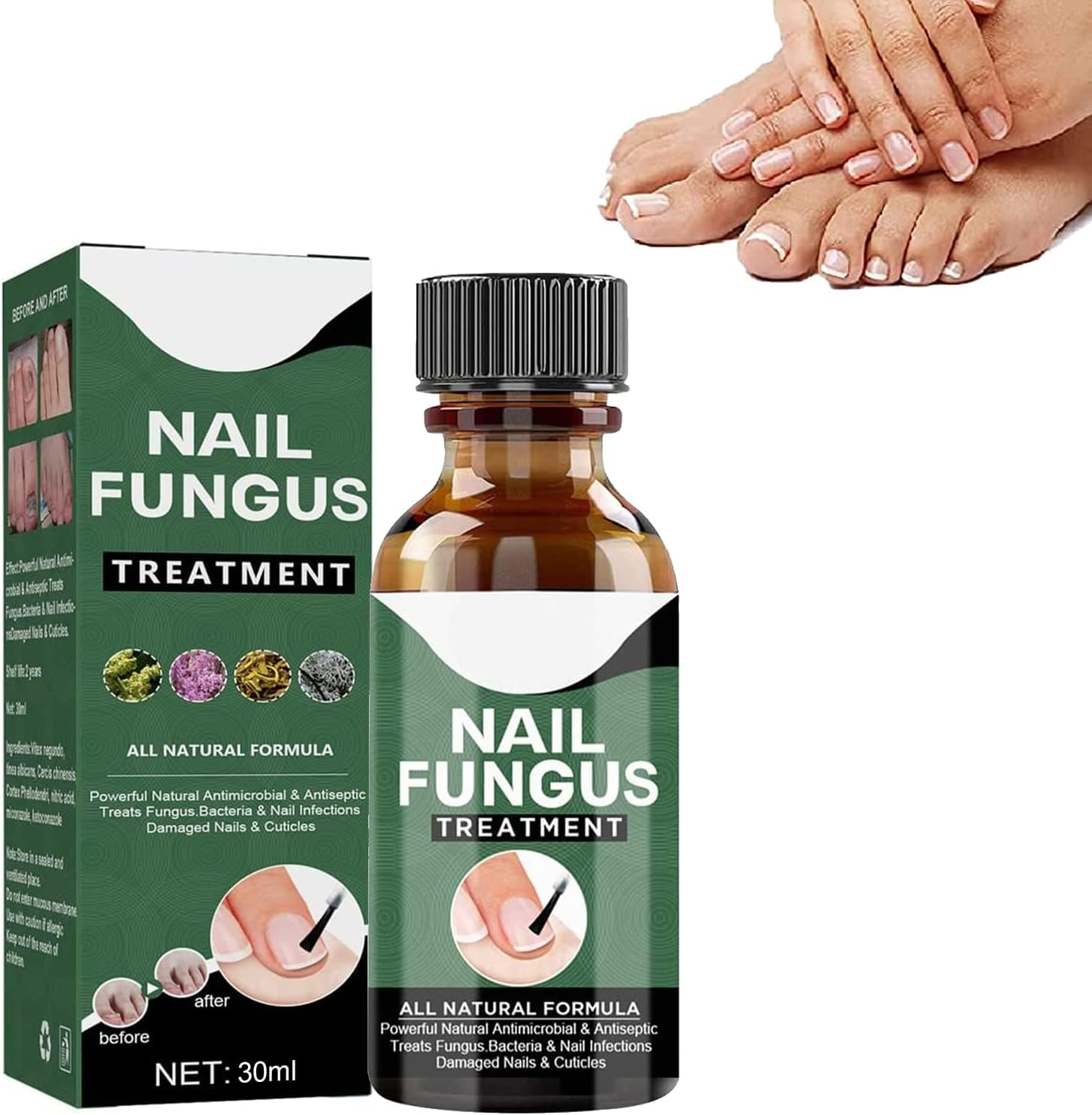 🔥This week's hot sale🔥repair nail fungus treatment serum
