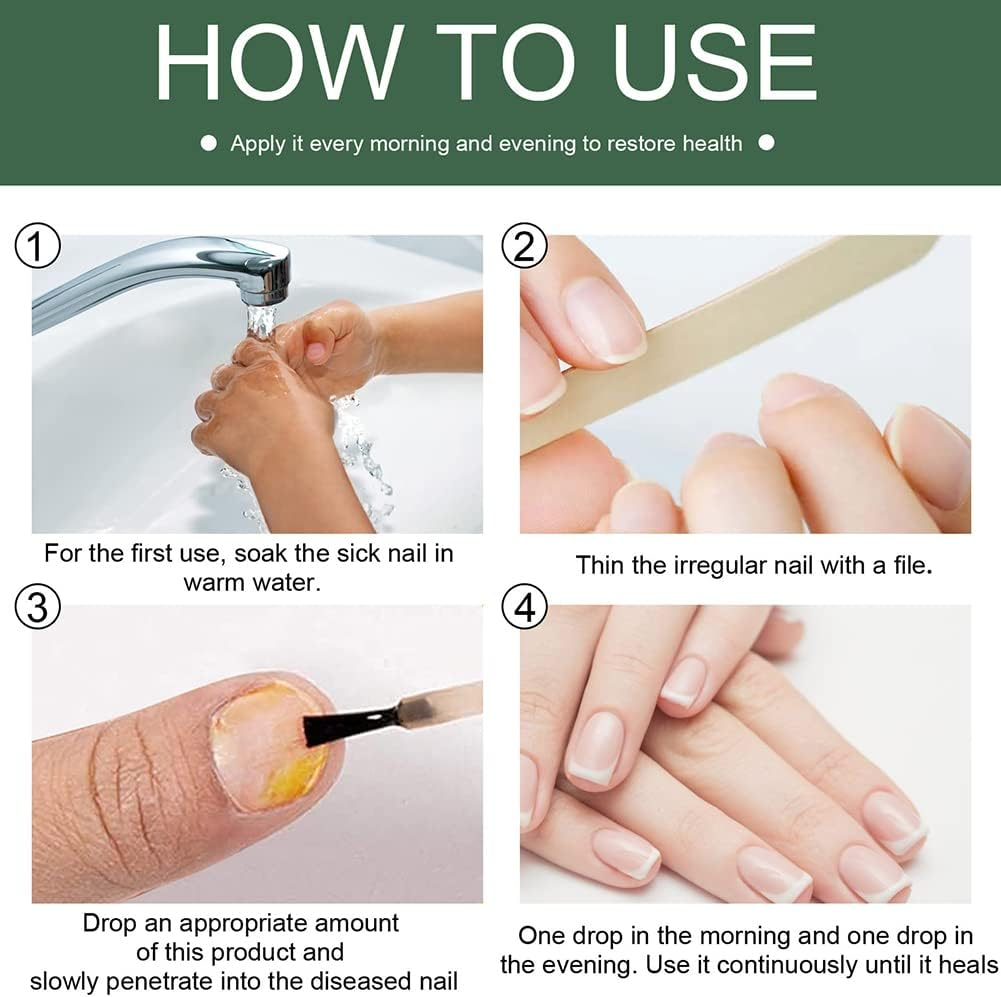 🔥This week's hot sale🔥repair nail fungus treatment serum