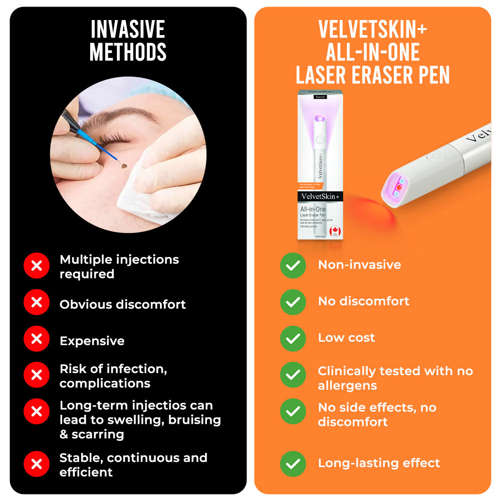 🔥This week's hot sale🔥All in One Laser Eraser Pen