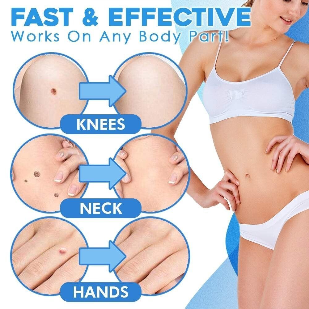 🔥This week's hot sale🔥 fast auto tag removal kit